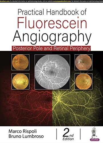 Stock image for PRACTICAL HANDBOOK OF FLUORESCEIN ANGIOGRAPHY: POSTERIOR AND RETINAL PERIPHERY: Posterior Pole and Retinal Periphery for sale by BookstoYou