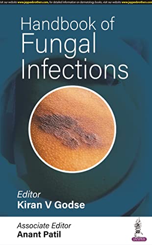 Imagen de archivo de Handbook of Fungal Infections a la venta por Books Puddle