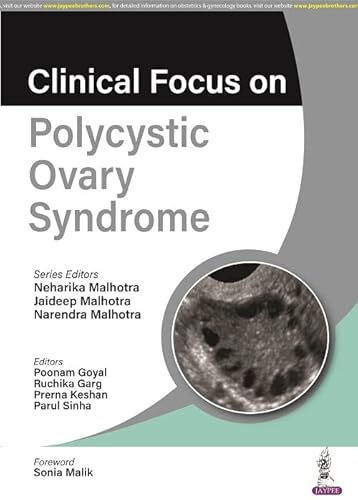 Beispielbild fr Clinical Focus On Polycystic Ovary Syndrome zum Verkauf von GreatBookPrices