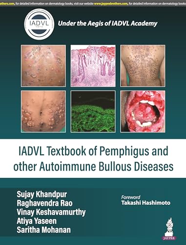 9789356961449: Textbook of Pemphigus and other Autoimmune Bullous Diseases