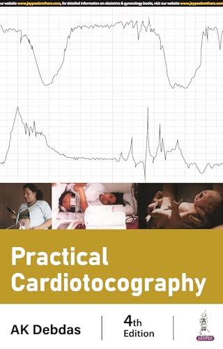 Stock image for Practical Cardiotocography for sale by Books Puddle