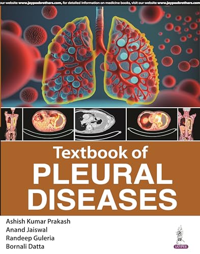 Stock image for Textbook of Pleural Diseases for sale by Ria Christie Collections