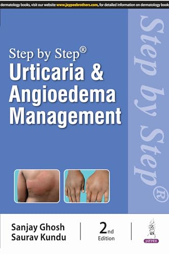 Stock image for Step By Step Urticaria And Angioedema Management for sale by Books Puddle