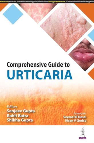 Immagine dell'editore per COMPREHENSIVE GUIDE TO URTICARIA venduto da Romtrade Corp.