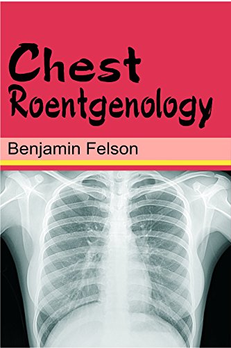 9789374734872: Chest Roentgenology