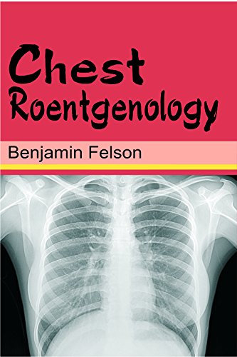 Stock image for Chest Roentgenology for sale by dsmbooks