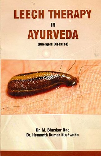 Stock image for Leech Therapy in Ayurveda (Buergers Diseases) for sale by dsmbooks