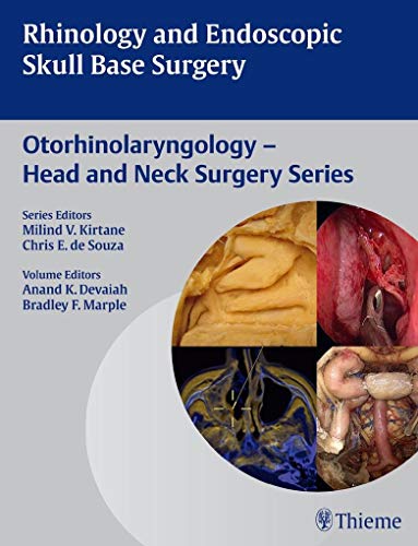 9789382076018: Rhinology and Endoscopic Skull Base Surgery (Otorhinolaryngology- Head and Neck Surgery Series, 3)