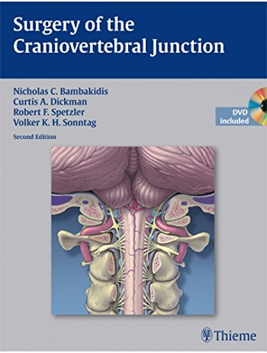 9789382076544: Surgery of the Craniovertebral Junction [Hardcover] [Jul 06, 2013] Bambakidis [Hardcover] [Jan 01, 2017] Bambakidis