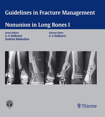 Stock image for GUIDELINES IN FRACTURE MANAGEMENT - NON-UNION IN LONG BONES PART I for sale by Romtrade Corp.