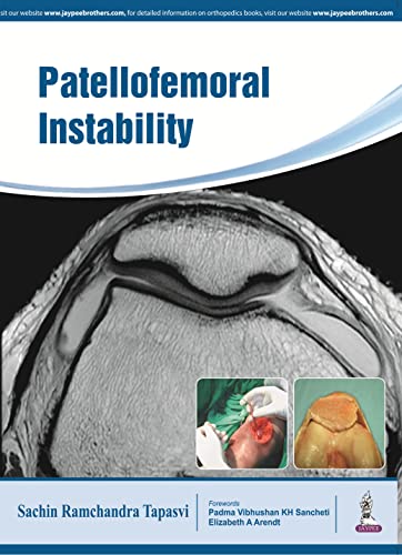 Stock image for Patellofemoral Instability: Knee Joint for sale by Chiron Media