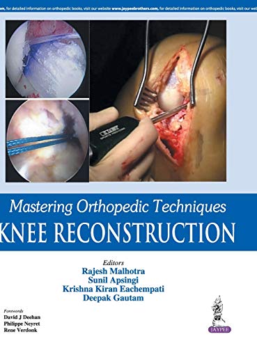 Stock image for Mastering Orthopedic Techniques: Knee Reconstruction for sale by Chiron Media