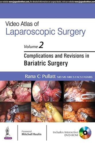 Stock image for Video Atlas of Laparoscopic Surgery for sale by Books Puddle