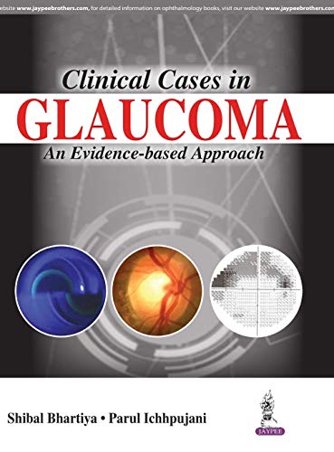 Stock image for Clinical Cases in Glaucoma an Evidence-Based Approach 1st Edition for sale by Romtrade Corp.