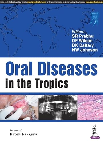 Beispielbild fr Oral Diseases in the Tropics zum Verkauf von HPB-Red