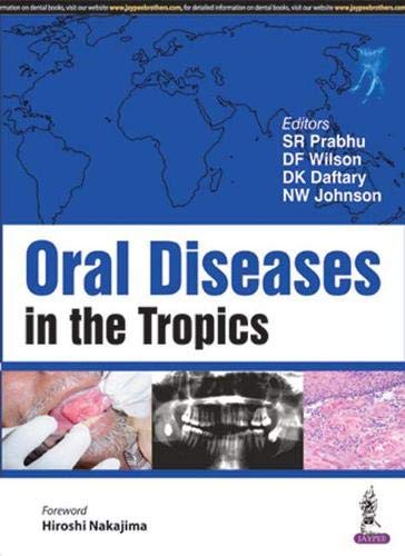 Stock image for Oral Diseases in the Tropics for sale by HPB-Red