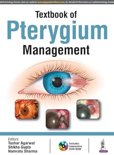 Stock image for TEXTBOOK OF PTERYGIUM MANAGEMENT WITH DVD-ROM for sale by Basi6 International