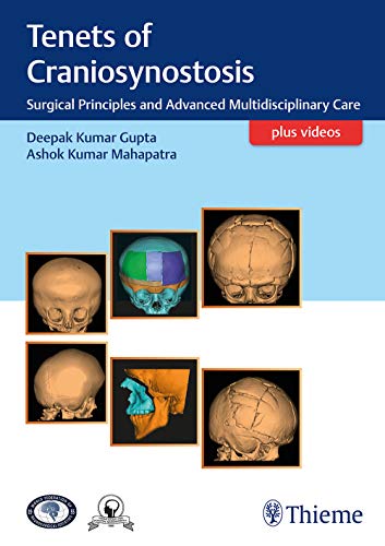 Beispielbild fr Gupta, Tenets of Craniosynostosis zum Verkauf von Blackwell's