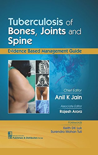 Stock image for Tuberculosis Of Bones Joints And Spine (Hb 2017) for sale by Kanic Books