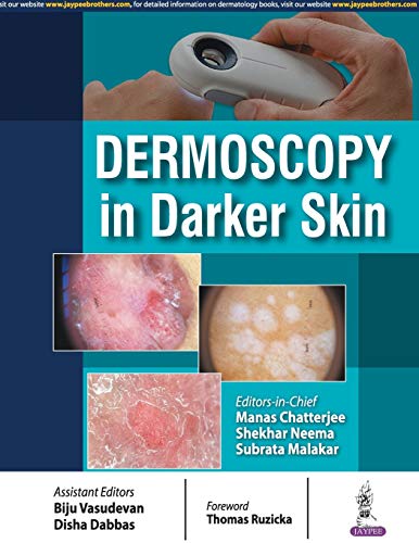 Stock image for DERMOSCOPY IN DARKER SKIN for sale by Romtrade Corp.