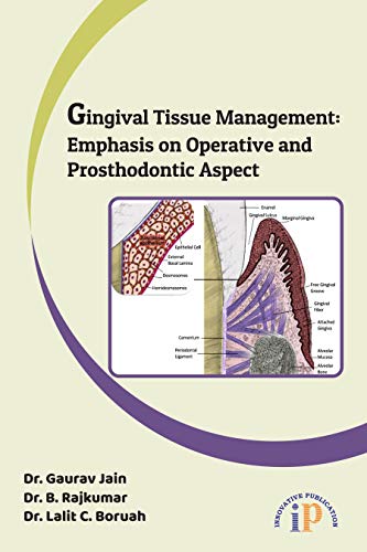 Beispielbild fr Gingival Tissue Management: Emphasis on Operative and Prosthodontic Aspect zum Verkauf von Vedams eBooks (P) Ltd