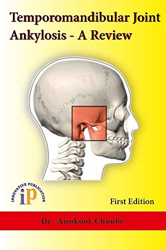 Stock image for Temporomandibular Joint Ankylosis A Review for sale by Vedams eBooks (P) Ltd