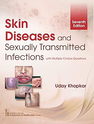 Stock image for Skin Diseases And Sexually Transmitted Infections (Pb 2019) for sale by Books Puddle