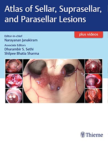 Stock image for ATLAS OF SELLAR, SUPRASELLAR AND PARASELLAR LESIONS: 1/E for sale by Romtrade Corp.