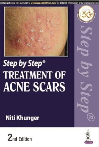 9789389188363: Step by Step Treatment of Acne Scars