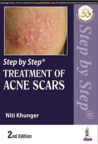 9789389188363: Step by Step Treatment of Acne Scars