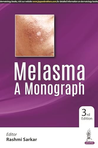 Stock image for Melasma: A Monograph for sale by Books Puddle