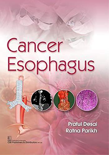 Beispielbild fr Cancer Esophagus zum Verkauf von Books From California