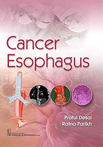 Stock image for Cancer Esophagus for sale by Books From California