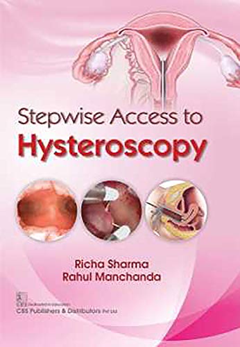 Beispielbild fr Stepwise Access to Hysteroscopy zum Verkauf von Books in my Basket