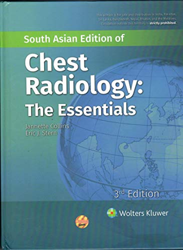 Stock image for Chest Radiology : The Essentials for sale by Books Puddle