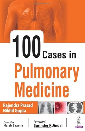 Stock image for 100 Cases in Pulmonary Medicine for sale by Books Puddle