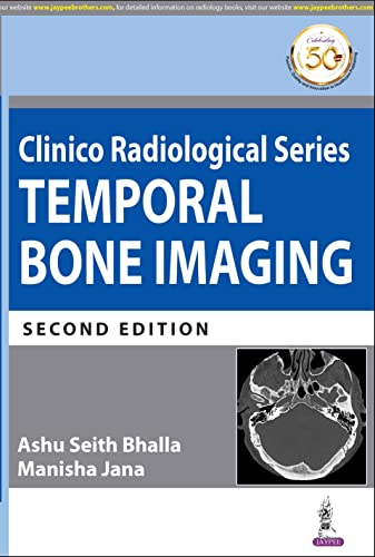 Stock image for Clinico Radiological Series: Temporal Bone Imaging for sale by Books Puddle