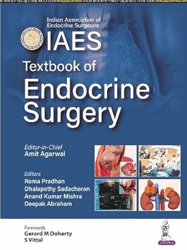 Beispielbild fr Textbook of Endocrine Surgery zum Verkauf von Monster Bookshop