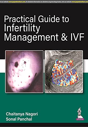 Beispielbild fr PRACTICAL GUIDE TO INFERTILITY MANAGEMENT & IVF zum Verkauf von Romtrade Corp.