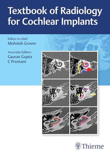 Stock image for Textbook of Radiology for Cochlear Implants for sale by Books Puddle