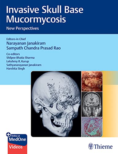 Stock image for Invasive Skull Base Mucormycosis for sale by Books Puddle