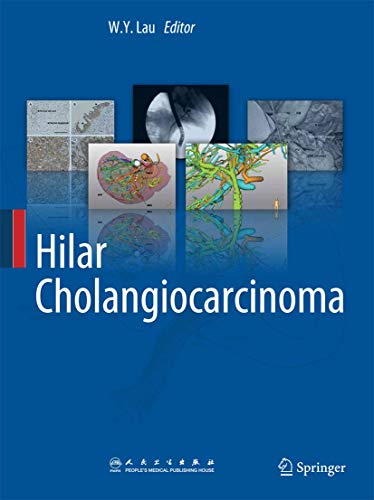 9789400764729: Hilar Cholangiocarcinoma