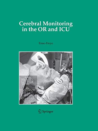 9789400792661: Cerebral Monitoring in the OR and ICU