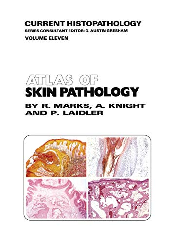 9789401083300: Atlas of Skin Pathology (Current Histopathology, 11)