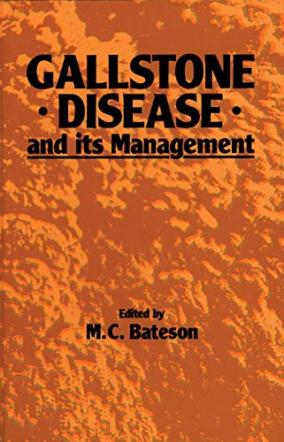 Gallstone Disease and its Management (9789401083539) by Bateson, M.C.