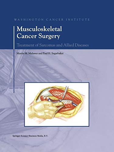 9789401741620: Musculoskeletal Cancer Surgery: Treatment of Sarcomas and Allied Diseases