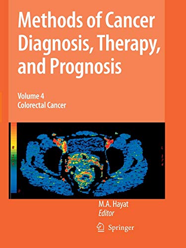 9789401777292: Methods of Cancer Diagnosis, Therapy and Prognosis: Colorectal Cancer: 4