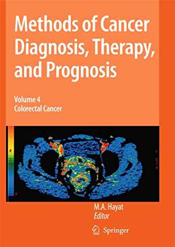 9789401777292: Methods of Cancer Diagnosis, Therapy and Prognosis: Colorectal Cancer (Methods of Cancer Diagnosis, Therapy and Prognosis, 4)