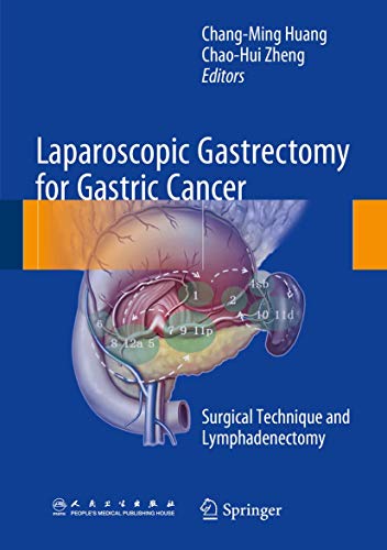 Beispielbild fr Laparoscopic Gastrectomy for Gastric Cancer. Surgical Technique and Lymphadenectomy. zum Verkauf von Universittsbuchhandlung Herta Hold GmbH