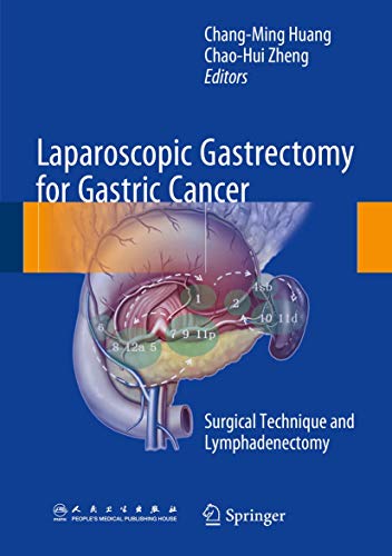9789401798723: Laparoscopic Gastrectomy for Gastric Cancer: Surgical Technique and Lymphadenectomy